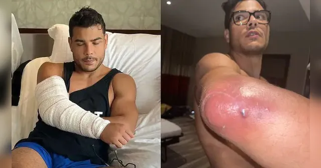 Imagem ilustrativa da notícia Infecção no cotovelo tira lutador brasileiro do UFC 294