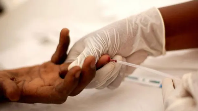 Imagem ilustrativa da notícia Casos de sífilis e de HIV/aids aumentam no Brasil