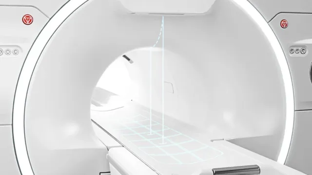 Imagem ilustrativa da notícia Beneficente Portuguesa traz Ressonância Magnética com IA 