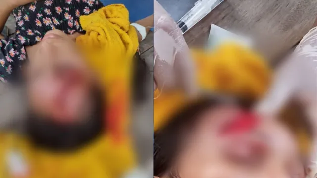 Imagem ilustrativa da notícia Vídeo: acidente entre "rabetas" deixa três feridos no Marajó