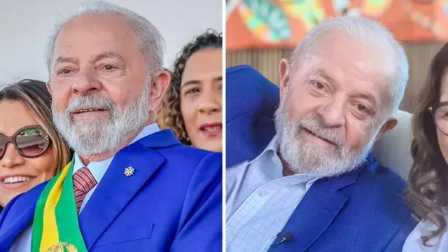 Imagem ilustrativa da notícia Lula passa por cirurgia plástica. Veja o antes e depois