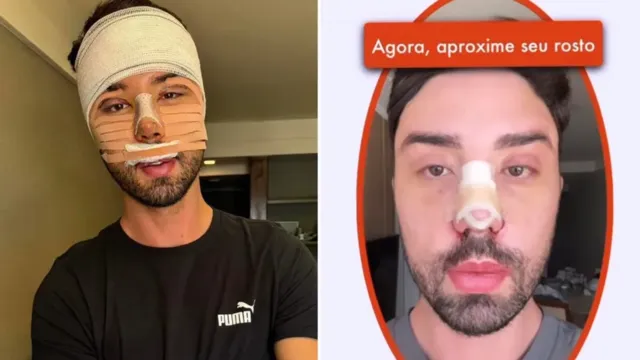 Imagem ilustrativa da notícia Rico diz que celular não o reconhece após plásticas no rosto
