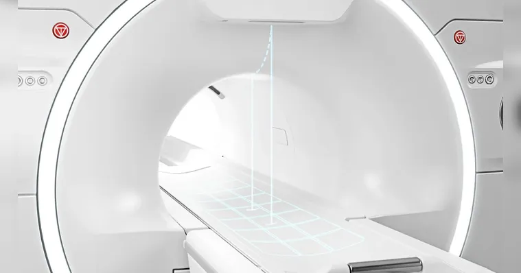 Imagem ilustrativa da notícia Beneficente Portuguesa traz Ressonância Magnética com IA 