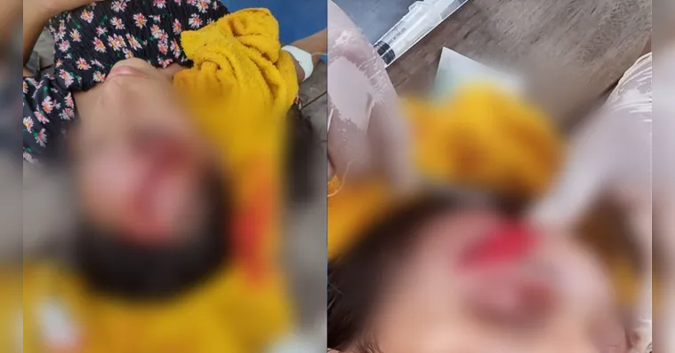 Imagem ilustrativa da notícia Vídeo: acidente entre "rabetas" deixa três feridos no Marajó