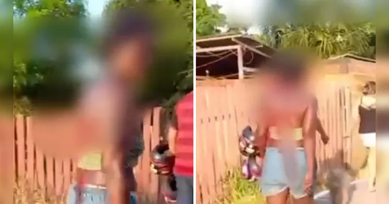 Imagem ilustrativa da notícia Vídeo: mulher fica com faca nas costas após briga de família