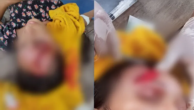 Imagem ilustrativa da notícia Vídeo: acidente entre "rabetas" deixa três feridos no Marajó