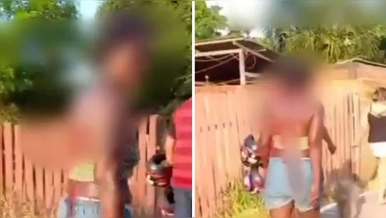 Imagem ilustrativa da notícia Vídeo: mulher fica com faca nas costas após briga de família