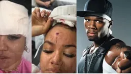 O rapper 50 Cent viralizou na internet após acertar fã com microfone.