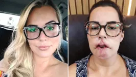 Antes e depois de Mariana Michelini.