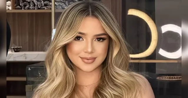 Imagem ilustrativa da notícia Modelo leva soco de síndico e fica com buraco no rosto