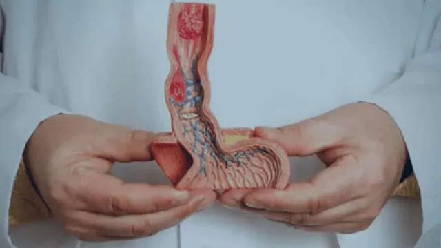 Imagem ilustrativa da notícia Câncer de pênis atinge 20 mil e tem quase 6 mil amputações