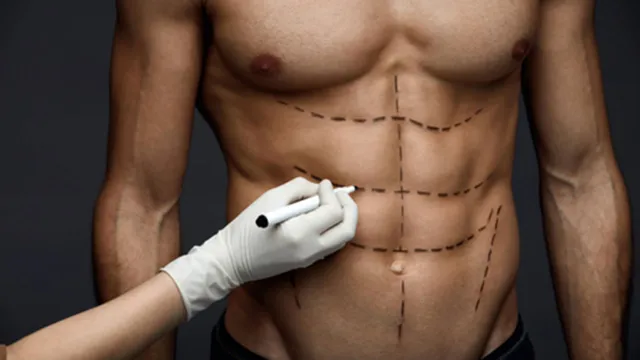 Imagem ilustrativa da notícia Brasil tem aumento de cirurgias plásticas em homens