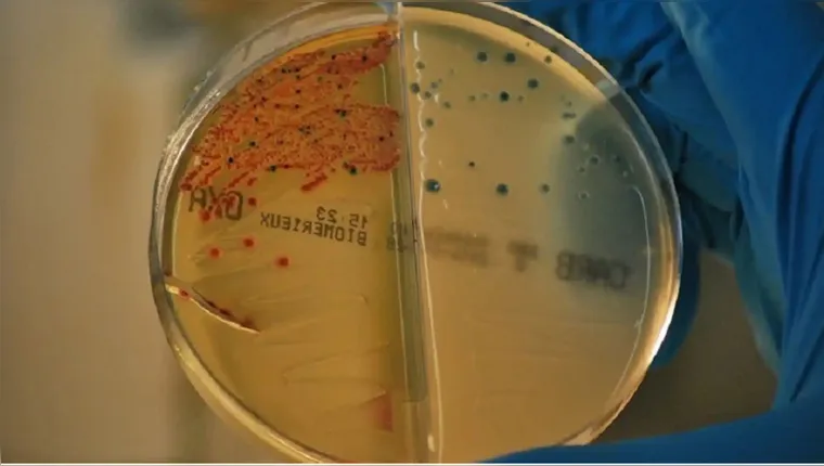 Imagem ilustrativa da notícia Descoberto antibiótico capaz de matar bactérias resistentes