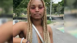 Skydajah Patterson, 26 anos, supostamente confessou ter matado brutalmente sua própria mãe