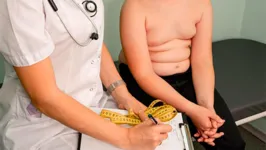 A obesidade, caracterizada pelo excesso de gordura corporal, tornou-se uma preocupação de saúde pública.
