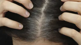 O fato é que os cabelos grisalhos não necessariamente são sinais de envelhecimento; no entanto, é preciso investigar suas origens.
