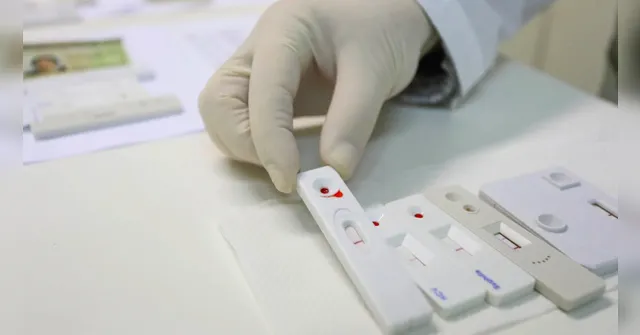 Imagem ilustrativa da notícia Novo teste de HPV no SUS antecipa diagnóstico em até 10 anos