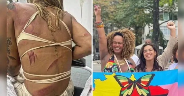 Imagem ilustrativa da notícia Assessora trans de vereadora é agredida em bar no RJ