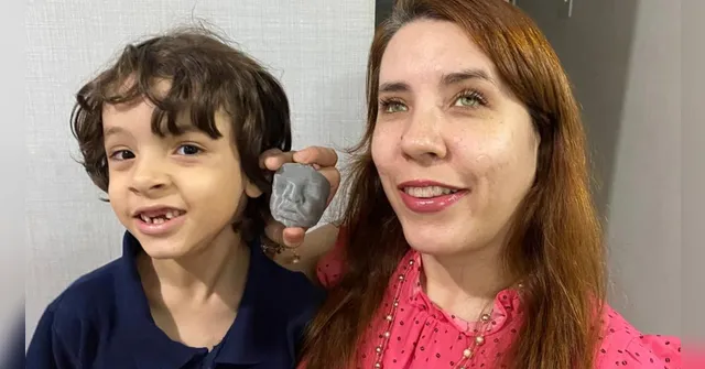 Imagem ilustrativa da notícia Impressão da Ultrassom 3D muda a vida de mães atípicas