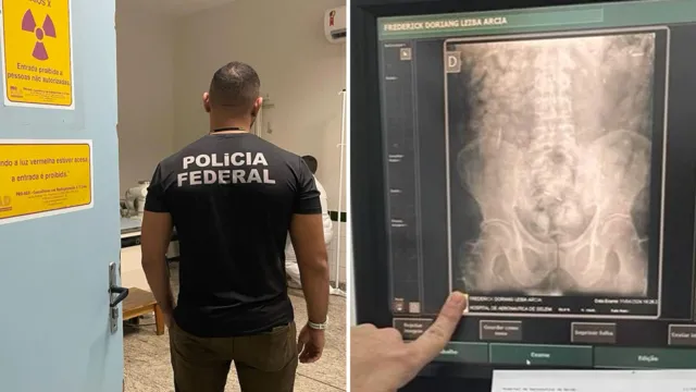 Imagem ilustrativa da notícia Homem é preso em Belém com cápsulas de cocaína no estômago