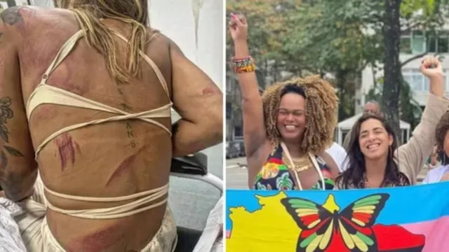 Imagem ilustrativa da notícia Assessora trans de vereadora é agredida em bar no RJ