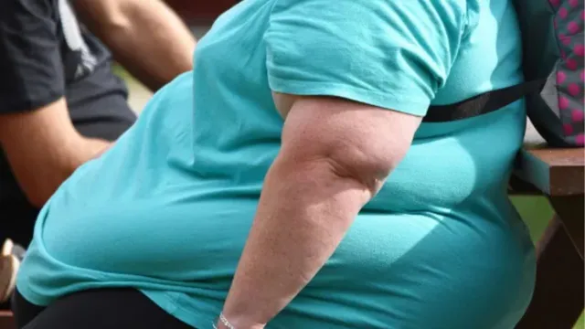 Imagem ilustrativa da notícia Obesidade: Instituto de Cardiologia faz alerta preocupante