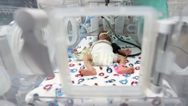 Imagem ilustrativa da notícia Recém-nascidos começam a morrer de fome em gaza, diz OMS