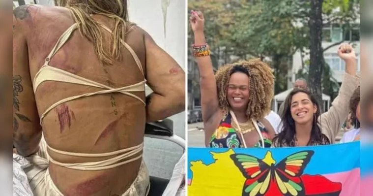 Imagem ilustrativa da notícia Assessora trans de vereadora é agredida em bar no RJ