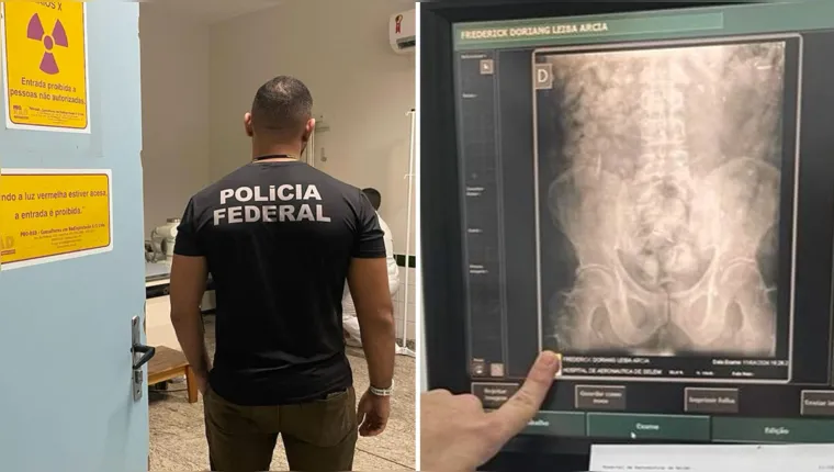 Imagem ilustrativa da notícia Homem é preso em Belém com cápsulas de cocaína no estômago