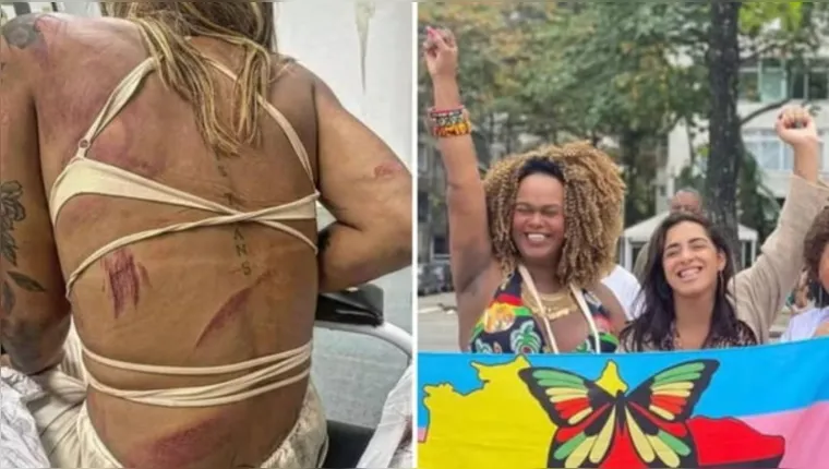 Imagem ilustrativa da notícia Assessora trans de vereadora é agredida em bar no RJ