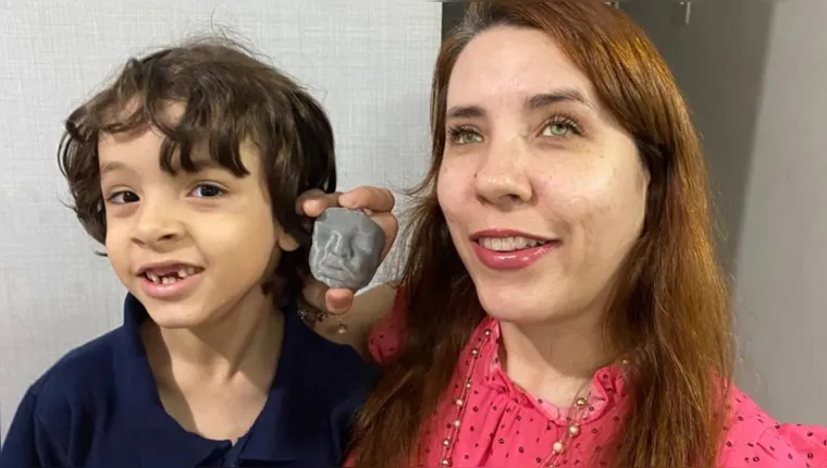 Imagem ilustrativa da notícia Impressão da Ultrassom 3D muda a vida de mães atípicas