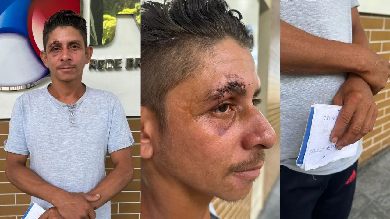 Marcelo Santos, foi assaltado e agredido no terminal rodoviário de Castanhal quando aguardava um ônibus para Belém.