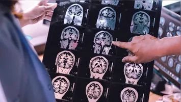 Pesquisador defendeu que os sonhos são uma forma de entender sobre a saúde do cérebro