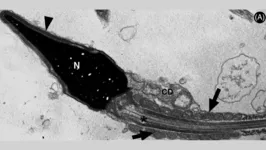 Imagem de espermatozóide de paciente com COVID-19 obtida por micrografia eletrônica