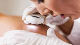 Consulta com dermatologista