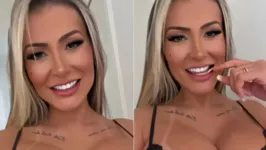 Andressa Urach mostrou como ficou a língua após a cirurgia e dividiu opiniões acerca dos riscos.