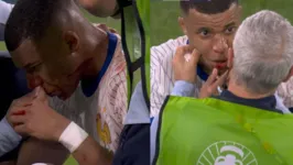 Mbappé quebrou o nariz no segundo tempo da estreia da Framça na Eurocopa, contra a Áustria.