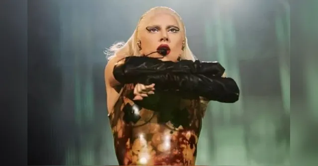 Imagem ilustrativa da notícia Lady Gaga conta que fez cinco shows de sua turnê com Covid