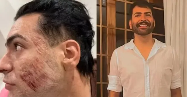 Imagem ilustrativa da notícia Empresário morreu após inalar fenol em peeling, aponta laudo