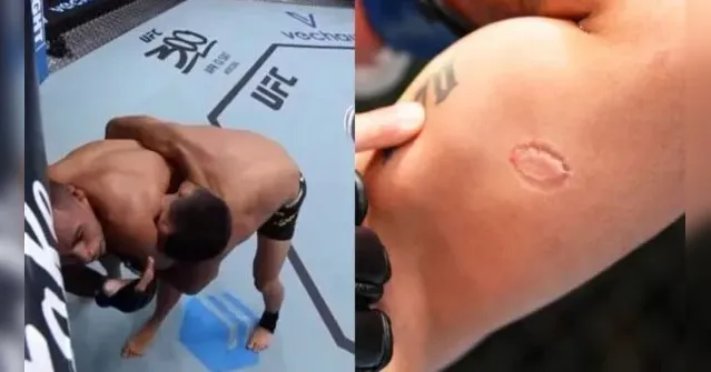 Imagem ilustrativa da notícia Paraense Igor Severino é suspenso por morder rival no UFC