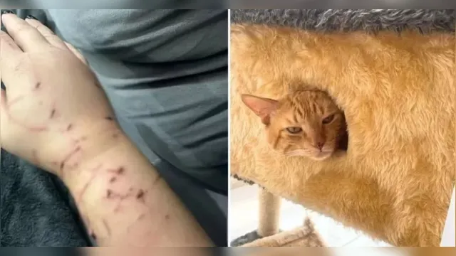 Imagem ilustrativa da notícia Gato ataca dona e faz família "refém" dentro de casa