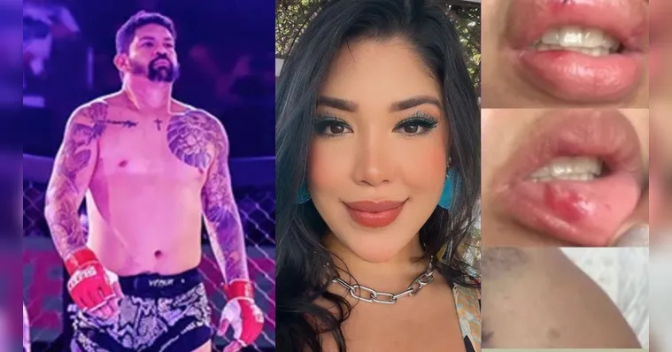 Imagem ilustrativa da notícia Lutador é preso por agredir a namorada, cantora gospel