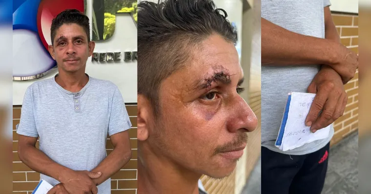 Imagem ilustrativa da notícia Roubado e agredido: Marcelo busca ajuda para encontrar irmão