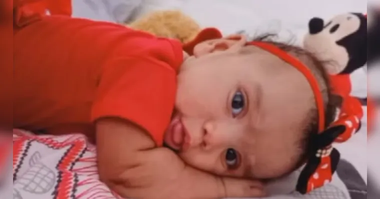 Imagem ilustrativa da notícia Bebê é morta por cachorro quando pais compravam álcool em GO