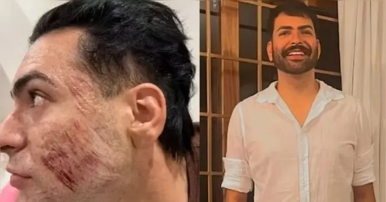 Imagem ilustrativa da notícia Empresário morreu após inalar fenol em peeling, aponta laudo