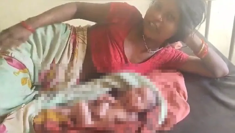 Imagem ilustrativa da notícia Bebê nasce com 4 braços, 4 pernas e duas cabeças na Índia 