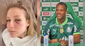 Ex acusa o jogador de agressão