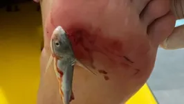 O bagre, um peixe que tem afiados "ferrões", pode ser encontrado em toda a costa brasileira