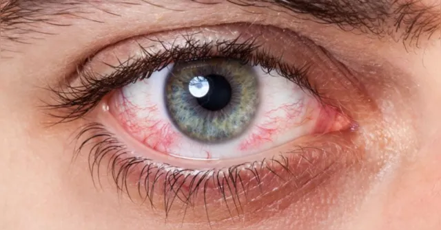 Imagem ilustrativa da notícia Doenças da retina podem causar baixa visão e cegueira