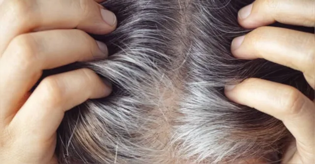 Imagem ilustrativa da notícia Células-tronco contribuem para cabelo ficar branco; entenda!
